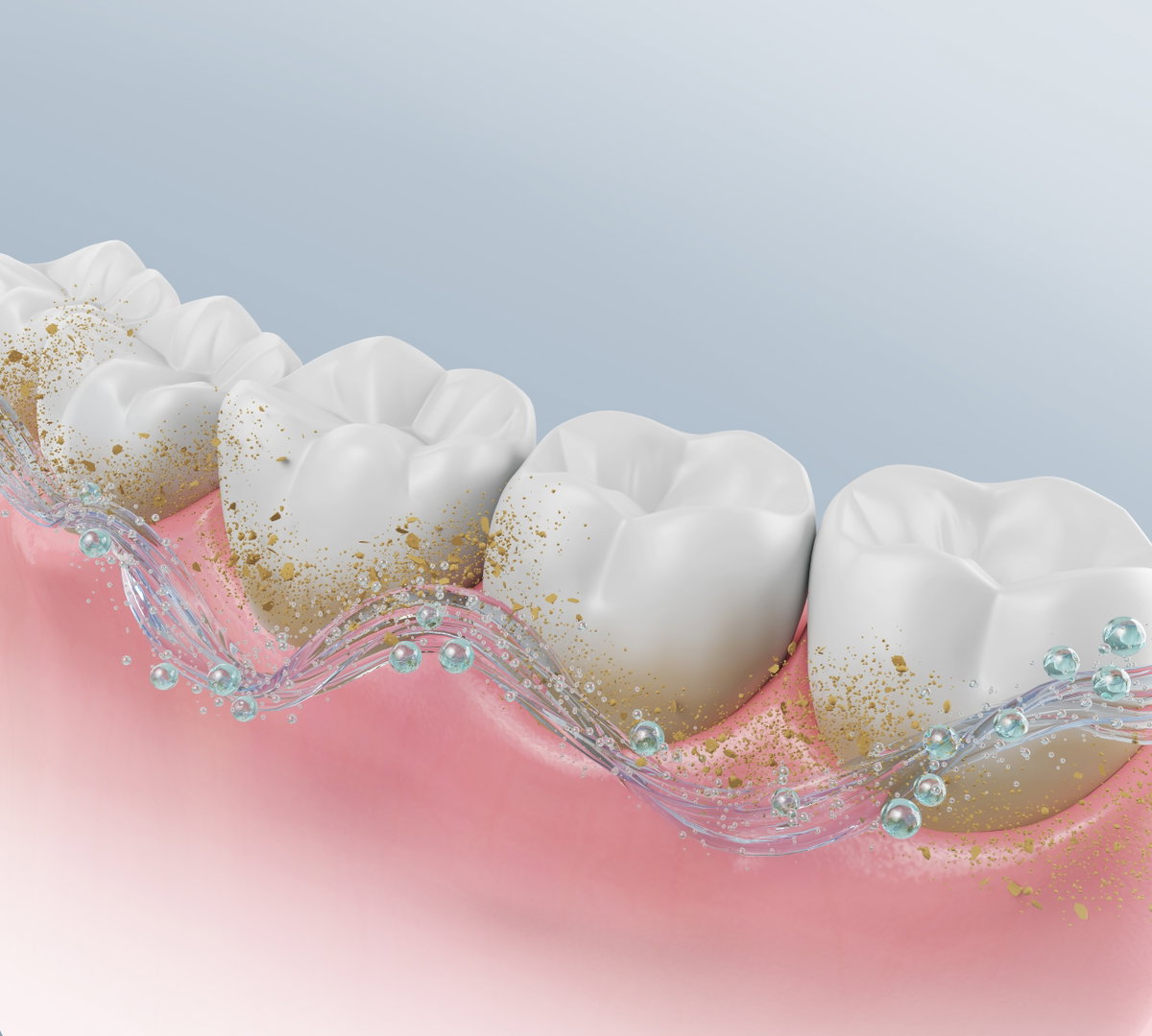 Dental Checkup And Cleaning