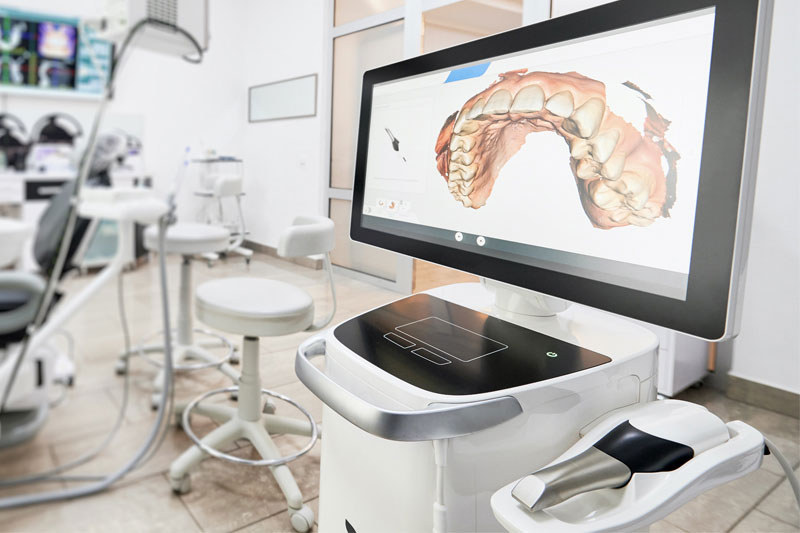 Intra-Oral Camera in
